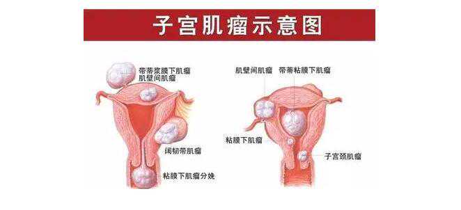 AB供卵A怀专业流程详解与代怀孕中介服务指南